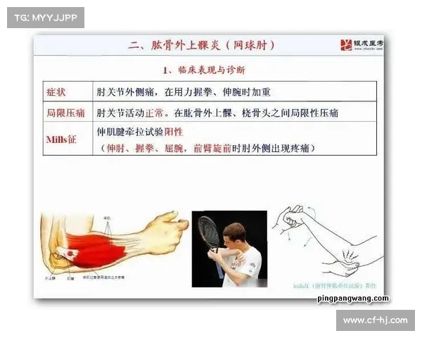 网球比赛中的常见伤病类型及其预防与恢复措施分析